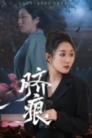 脐痕